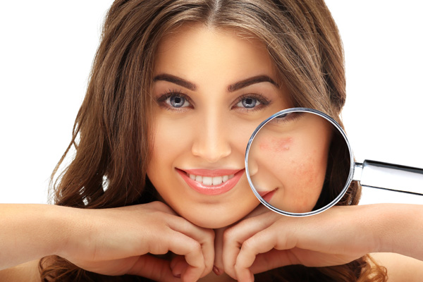 acne scars treatment bangalore