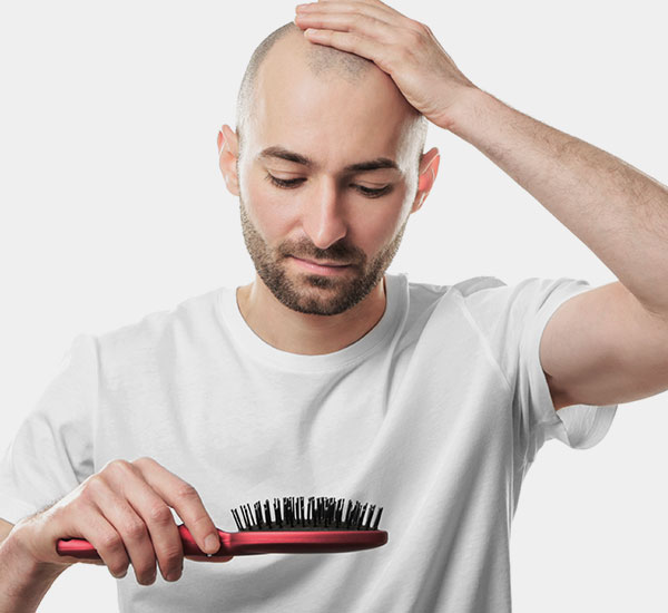 male Hair loss treatment Bangalore